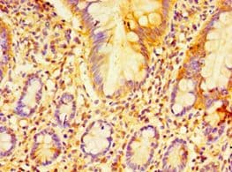 Polyclonal Rabbit anti-Human ECSIT Antibody (aa185-431, IHC, WB)
