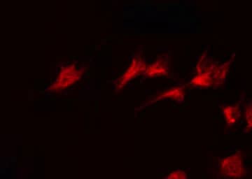 Polyclonal Rabbit anti-Human PPM1K Antibody (IHC, IF, WB)