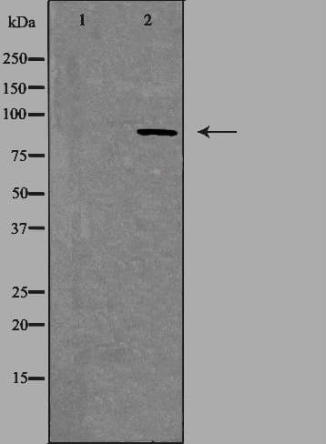 Polyclonal Rabbit anti-Human MAPK8IP2 / JIP2 Antibody (IHC, IF, WB)