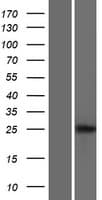 LIPT2 Protein (Over-Expression Lysate Myc-DDK (Flag))