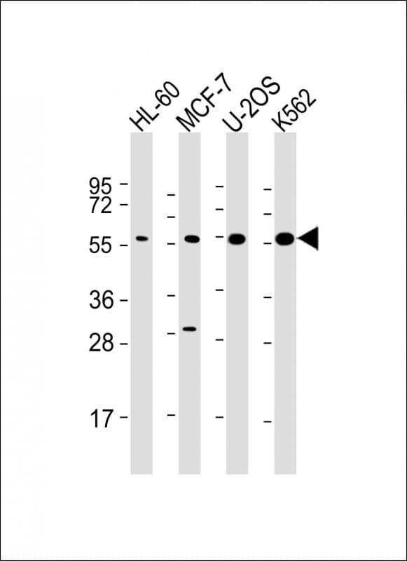 EIF2B3 Antibody (clone 1778CT889.66.6.54)