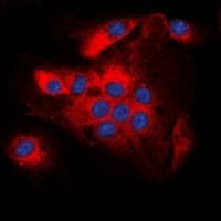 BCL2 / Bcl-2 Antibody (phospho-Thr56)