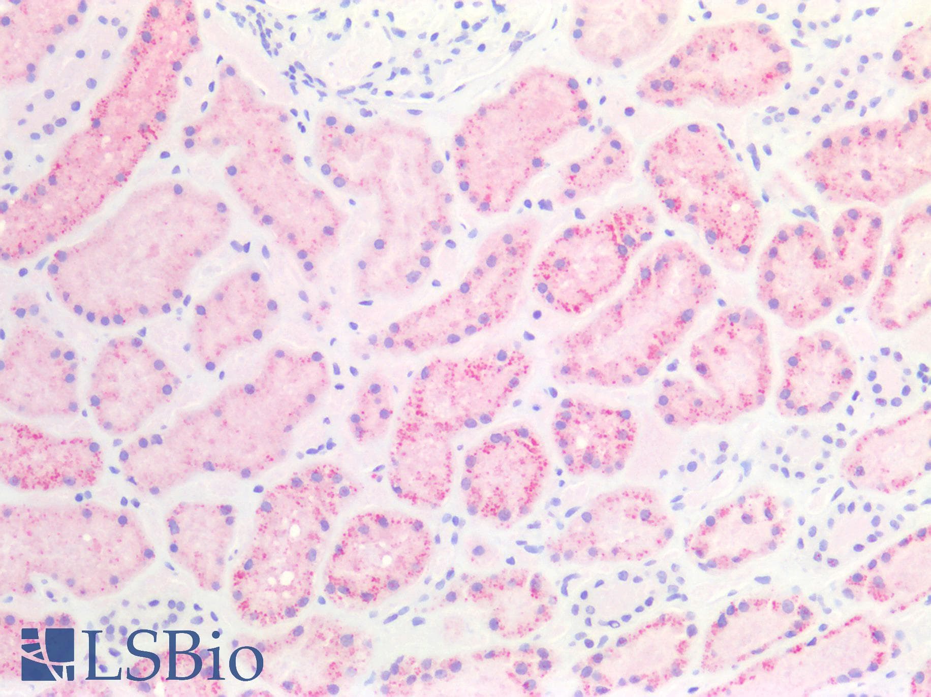 IHC-plus™ Polyclonal Rabbit anti-Human NAPSA / NAPA / Napsin A Antibody (IHC)