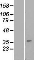 Human IGFLR1 / TMEM149 Protein (Over-Expression Lysate Myc-DDK (Flag))