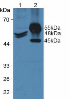 KRT20 / CK20 / Cytokeratin 20 Antibody (aa9-424)