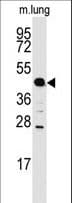 PathPlus™ ACPP / PAP Antibody (aa313-341)