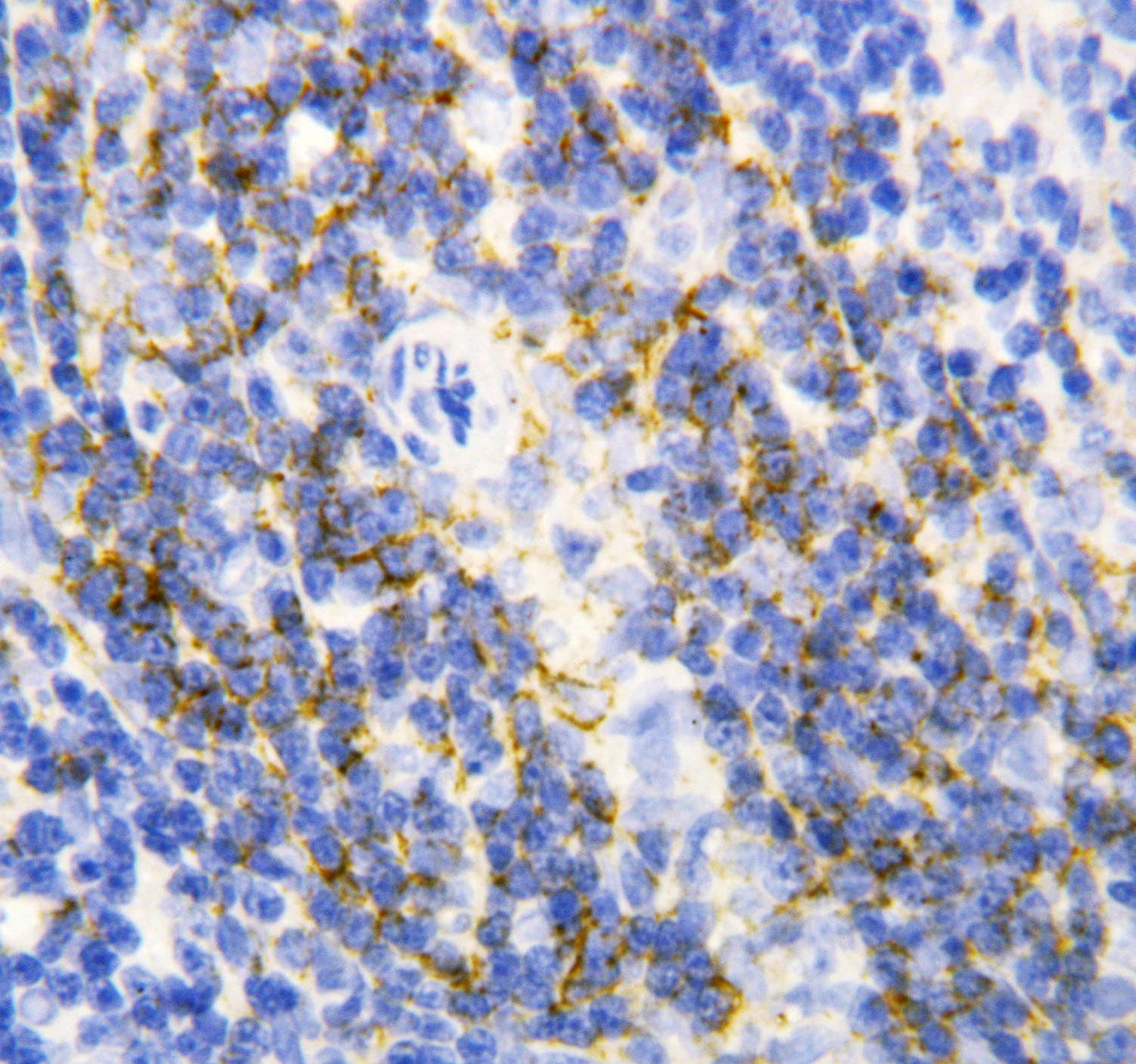 ANXA6/Annexin A6/Annexin VI Antibody (aa636-652)