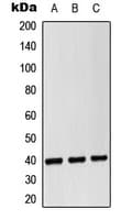 CD14 Antibody (Internal)