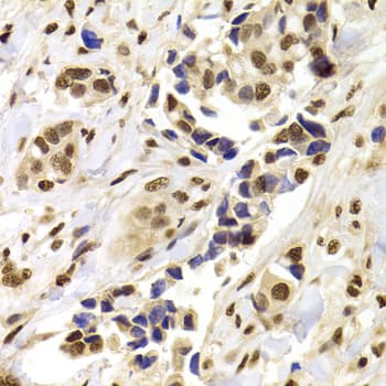 PPP1R8 / Rnase E Antibody