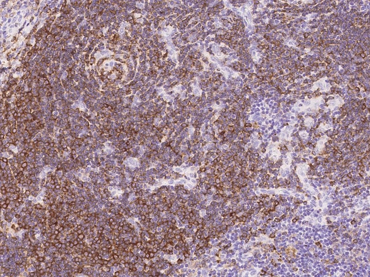 Polyclonal Rabbit anti-Human BCAP / PIK3AP1 Antibody (IHC)