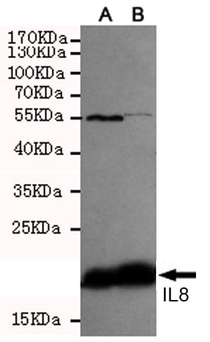 IL8 / Interleukin 8 Antibody
