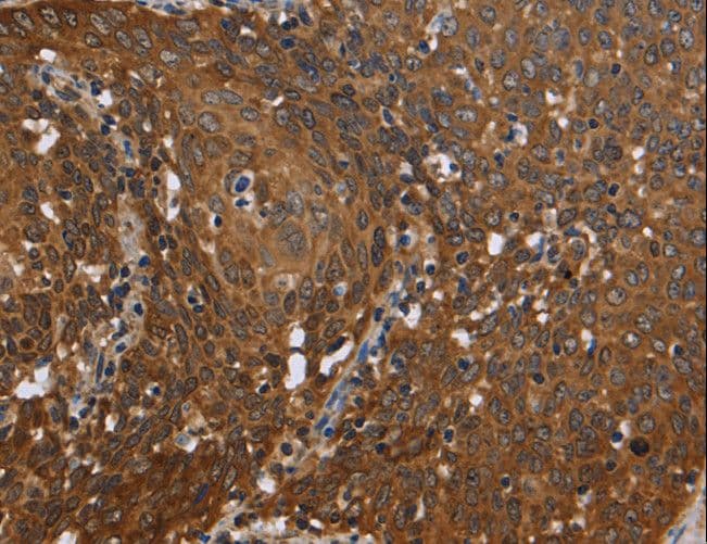 REL / C-Rel Antibody