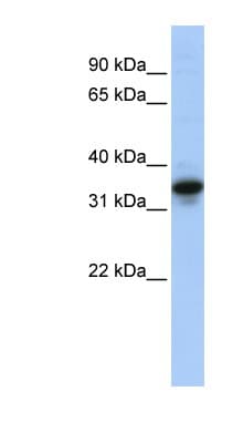 Polyclonal Rabbit anti-Human MUC3B Antibody (aa36-85, WB)