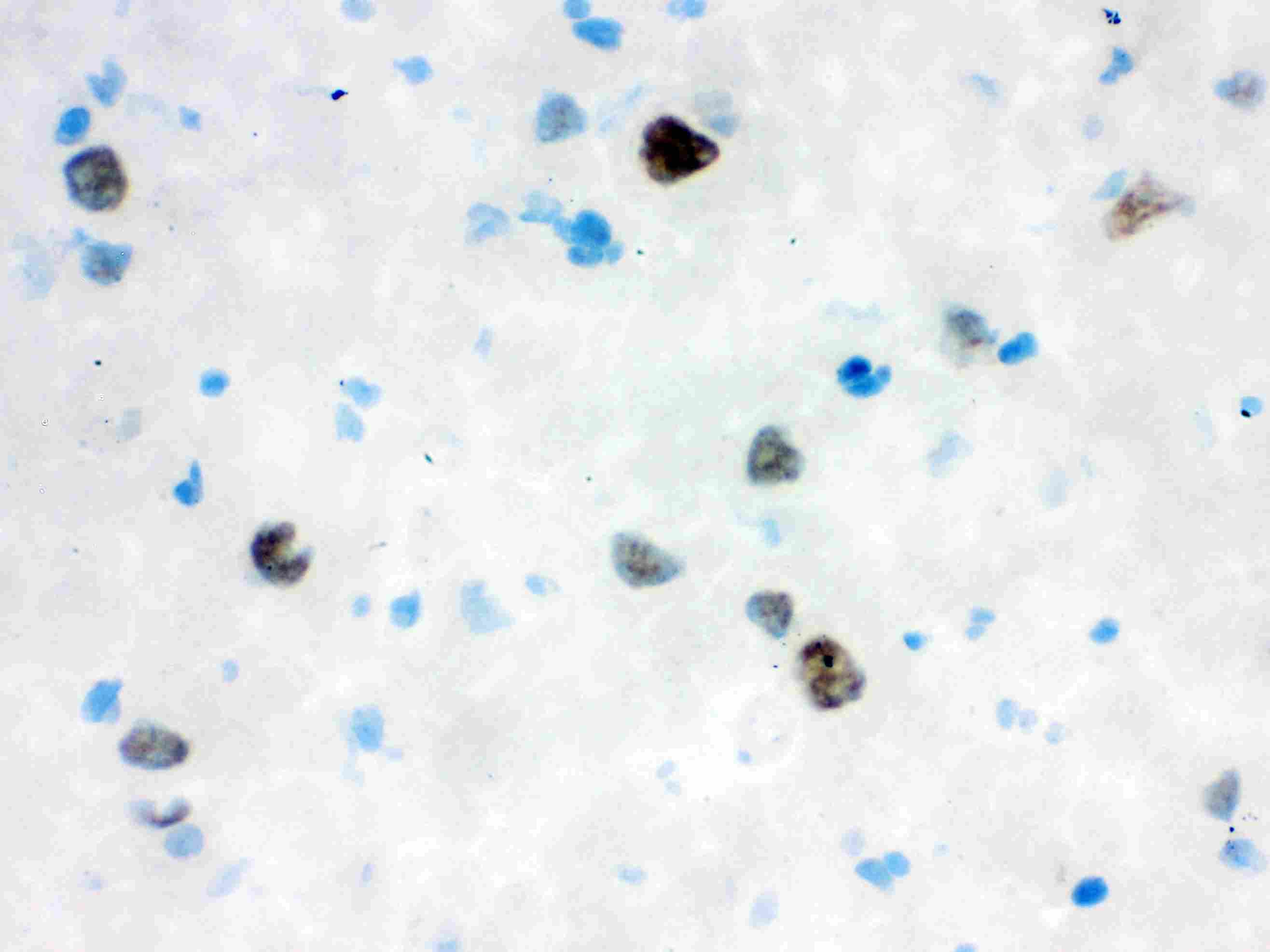 Polyclonal Rabbit anti-Human VCP Antibody (IHC, WB)
