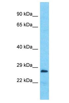 FRG2B Antibody (aa50-99)