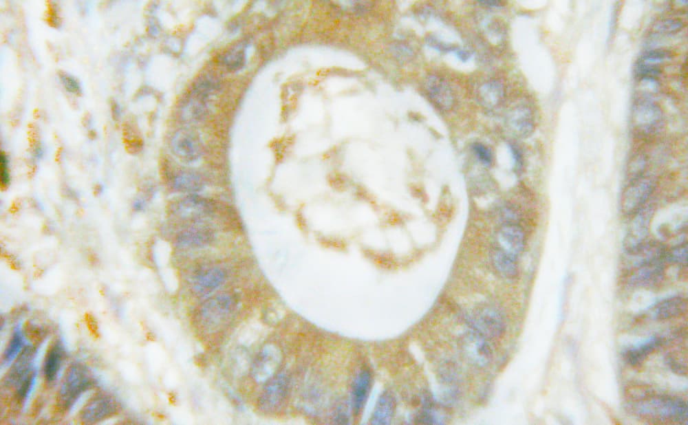 NCF1 / p47phox / p47 phox Antibody (phospho-Ser359)