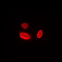 AURKB / Aurora-B Antibody (N-Terminus)