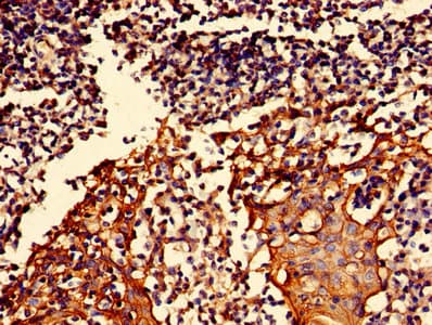 Polyclonal Rabbit anti-Human S100A16 Antibody