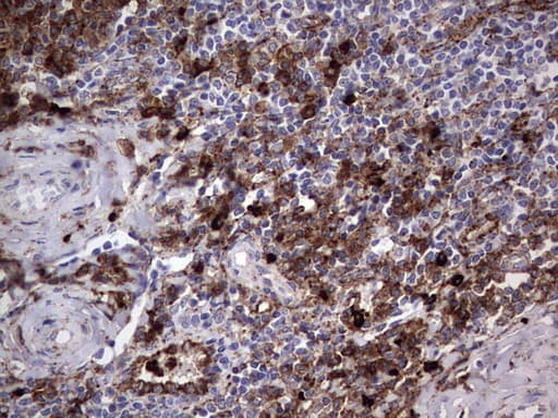 Monoclonal Mouse anti-Human CD63 Antibody (clone OTI5E5, IHC, WB)