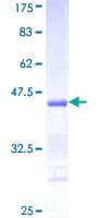 Human DAPK3 / ZIP Kinase Protein (Recombinant GST, N-terminus)