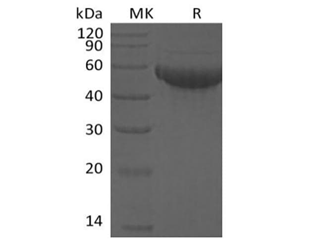 Human SIGLEC8 Protein (Recombinant 6His, C-terminus)
