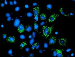 AK4 / Adenylate Kinase 4 Antibody (clone OTI1H1, Carrier-free)