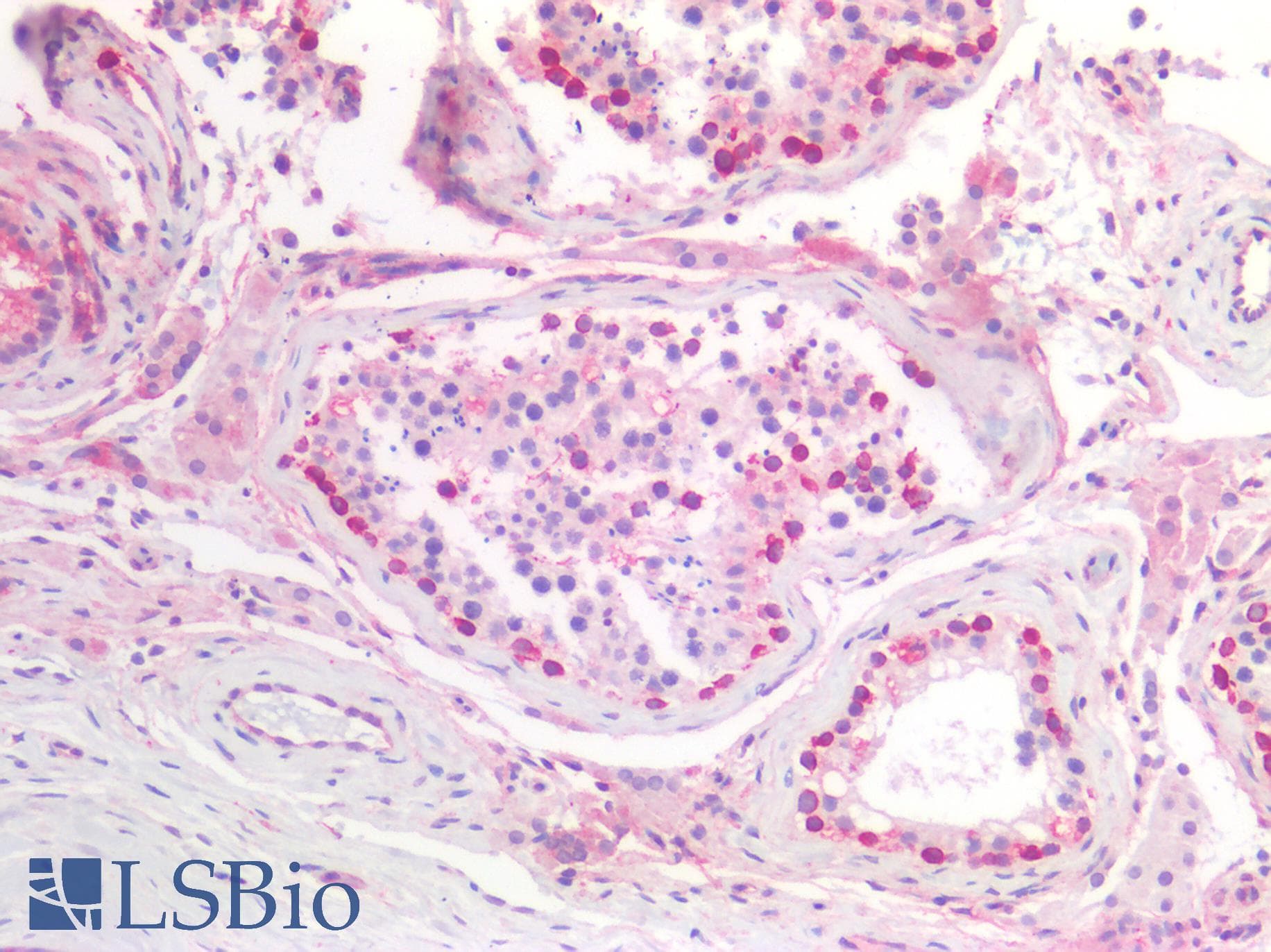 IHC-plus™ Polyclonal Rabbit anti-Human XRCC6 / Ku70 Antibody (acetylation site of K539., IHC, WB)