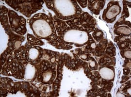 NME1 / NM23 Antibody (clone OTI4H2)