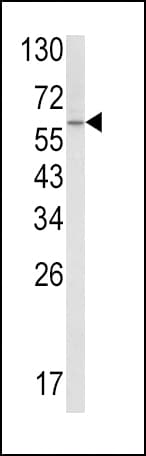 SCP2 / SCPX Antibody (aa358-385)