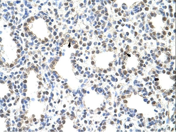 PRMT5 Antibody (aa21-70, Biotin)