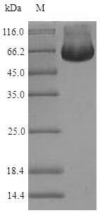 Human TIP48 / RUVBL2 Protein (Recombinant 6His-SUMO, N-terminus)