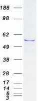 Human IFIT1 / ISG56 Protein (Recombinant Myc-DDK (Flag))