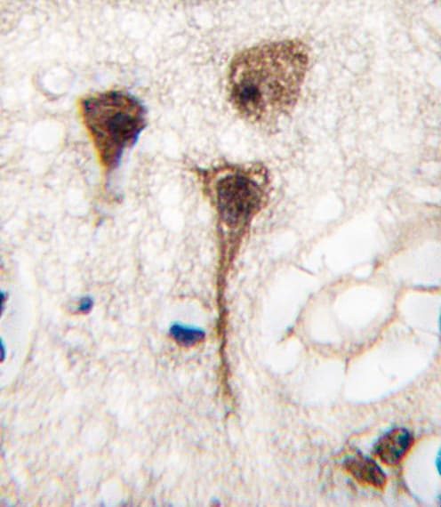 MEF2C Antibody (Thr300)