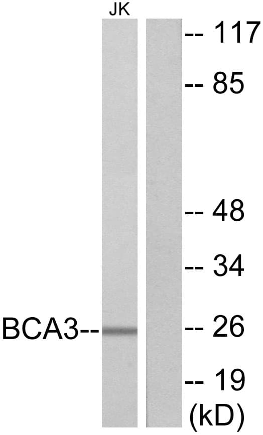 AKIP1 / BCA3 Antibody (aa111-160)
