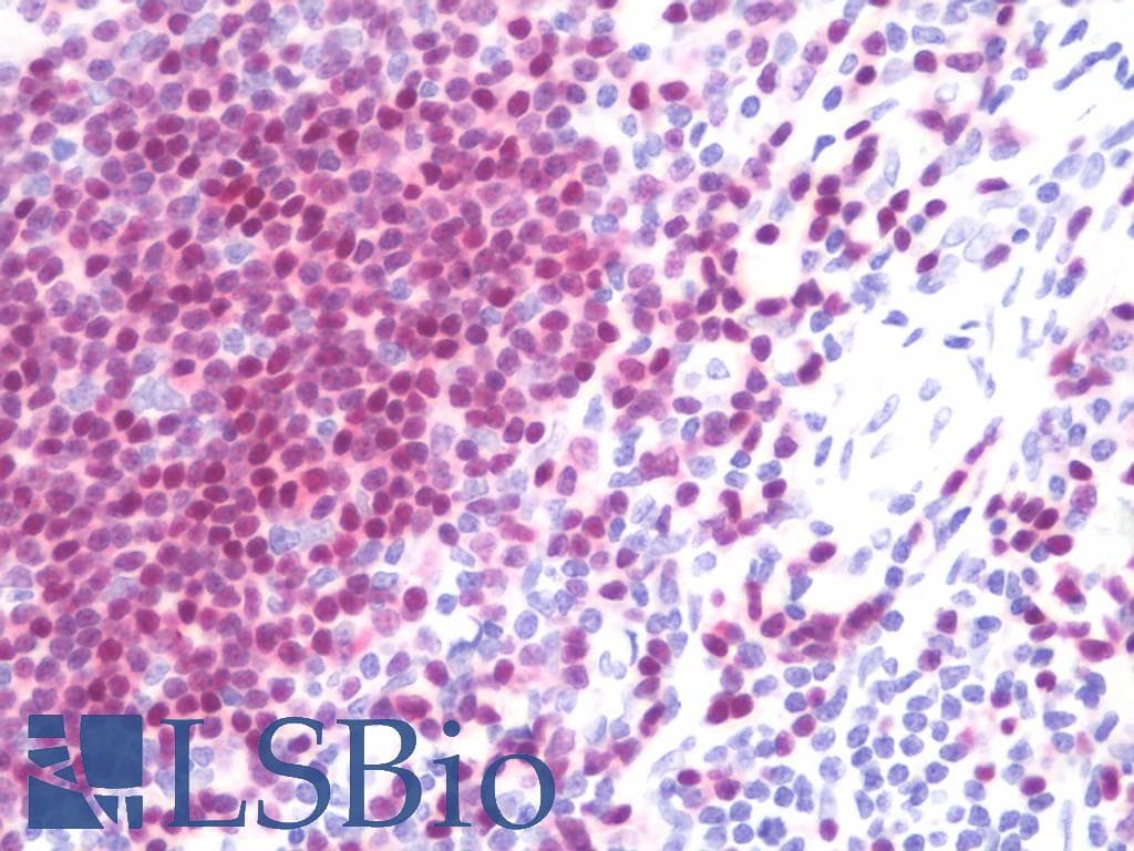 PathPlus™ PAX5 Antibody (clone 7D3)
