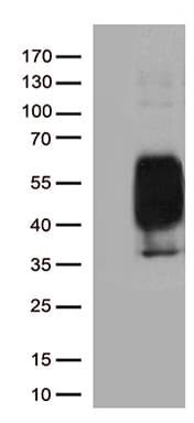PDCD1 / CD279 / PD-1 Antibody (clone UMAB198)