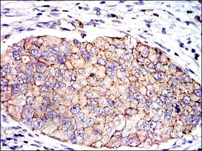 SERPINE1 / PAI-1 Antibody (clone 1D5)