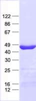 Human FBXO28 Protein (Recombinant His, N-Terminal)