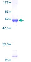 Human GNMT Protein (Recombinant GST)