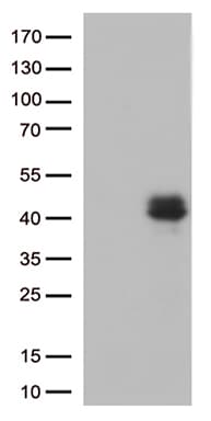 CTGF Antibody (aa27-349, clone OTI5H7)