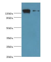DIS / CCAR1 Antibody (aa1-200)