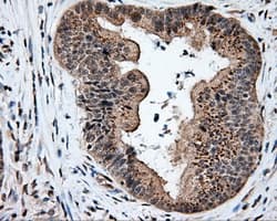 Monoclonal Mouse anti-Human SRR / Serine Racemase Antibody (clone OTI5D10, IHC, WB)