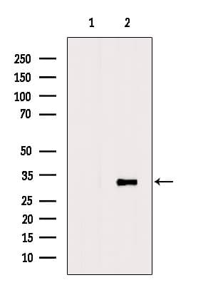 Polyclonal Rabbit anti-Human SARNP / Hcc-1 / CIP29 Antibody (IF, WB)