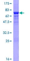 Human SULT2B1 / Sulfotransferase 2B1 Protein (Recombinant GST)