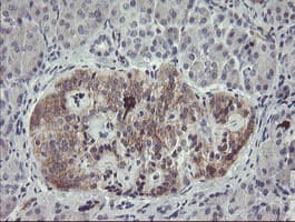 EIF5A2 Antibody (clone OTI6G7)
