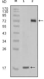 Monoclonal Mouse anti-Human STYK1 Antibody (clone 2H2F10, IHC, WB)