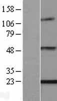 ENPP6 Protein (Over-Expression Lysate Myc-DDK (Flag))