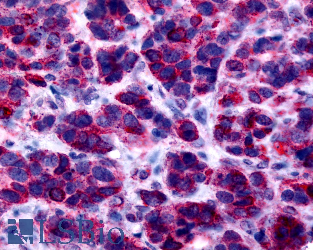 PathPlus™ Polyclonal Rabbit anti-Human GPER1 / GPR30 Antibody (Cytoplasmic Domain, IHC, IF, WB)
