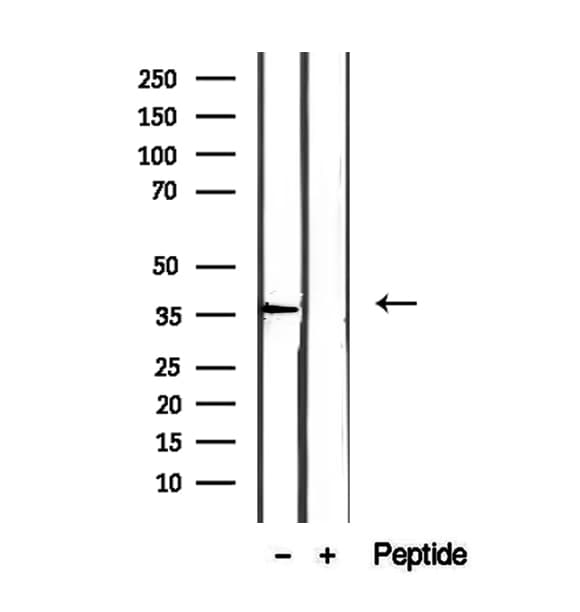 EIF3I / EIF3S2 Antibody