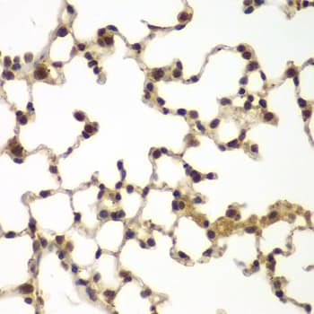 SULT2B1 / Sulfotransferase 2B1 Antibody